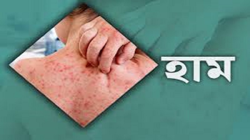 হামে এক দিনে আরও ৬ মৃত্যু, প্রাণহানি বেড়ে ১ হাজার ৩৬